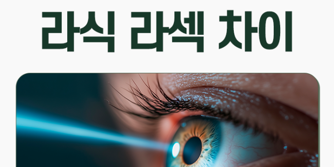 잠실안과 라식 라섹 수술 방식 차이