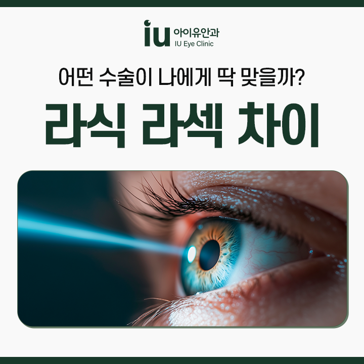 잠실안과 라식 라섹 수술 방식 차이